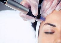 Microneedling Meso  mit Microdermabrasion und Heimpflege Produkte Niedersachsen - Barsinghausen Vorschau