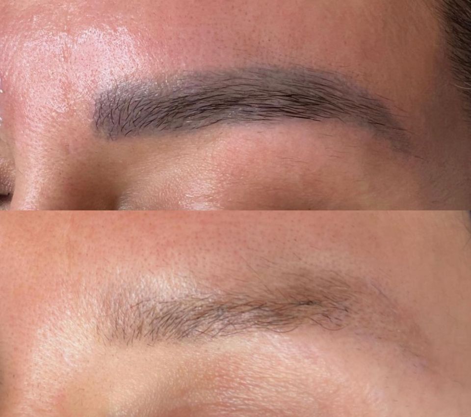 PMU Remover/ Powderbrows Microblading Entfernung/ Tattoo Remover in Bielefeld