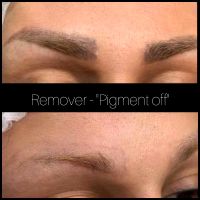 Entfernung Microblading Permanent Make-up Wandsbek - Hamburg Poppenbüttel Vorschau