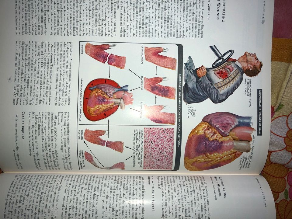 Medical Illustrations the Heart Frank Netter Buch in München