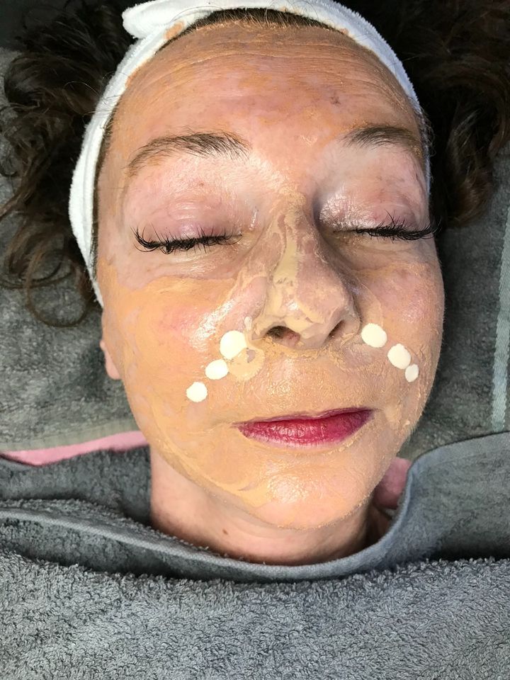 2 in 1 Microneedling und BB Glow Schulung in Kaltenkirchen