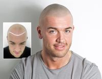 Haarpigmentierung Hair Tattoo in Rosenheim SMP Scalp Micro Pigmentation Haartätowierung Haar Pigmentierung Rosenheim Bayern - Rosenheim Vorschau