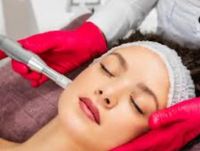 Microneedling Saarbrücken - St Johann Vorschau