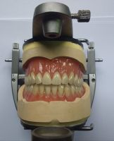 Schaumodell Totalprothese/Zahntechnik/Vollprothese/28 er/Dental Nordrhein-Westfalen - Bad Oeynhausen Vorschau