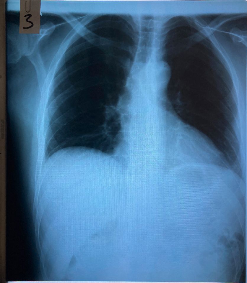 Röntgenbilder Thorax (A) als Deko/für Schulungszwecke in Berlin