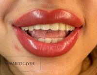 MOBILE KOSMETIK! Permanent make up / Falten Entfernung-Plasma Pen Bielefeld - Bielefeld (Innenstadt) Vorschau