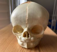 Schädel für Osteopathie Neugeborenes Hessen - Bad Vilbel Vorschau