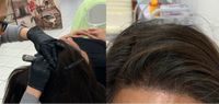 Kopfhautpigmentierung -Scalp -Haarneedling Schulung Hessen - Bad Vilbel Vorschau