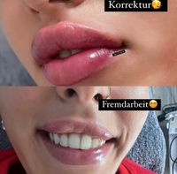 Lippenvolumen,Russianlips,Lippenunterspritzung Baden-Württemberg - Ludwigsburg Vorschau