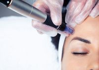 BB Glow + Micro-Needling Gesichtsbehandlung Rheinland-Pfalz - Traben-Trarbach Vorschau