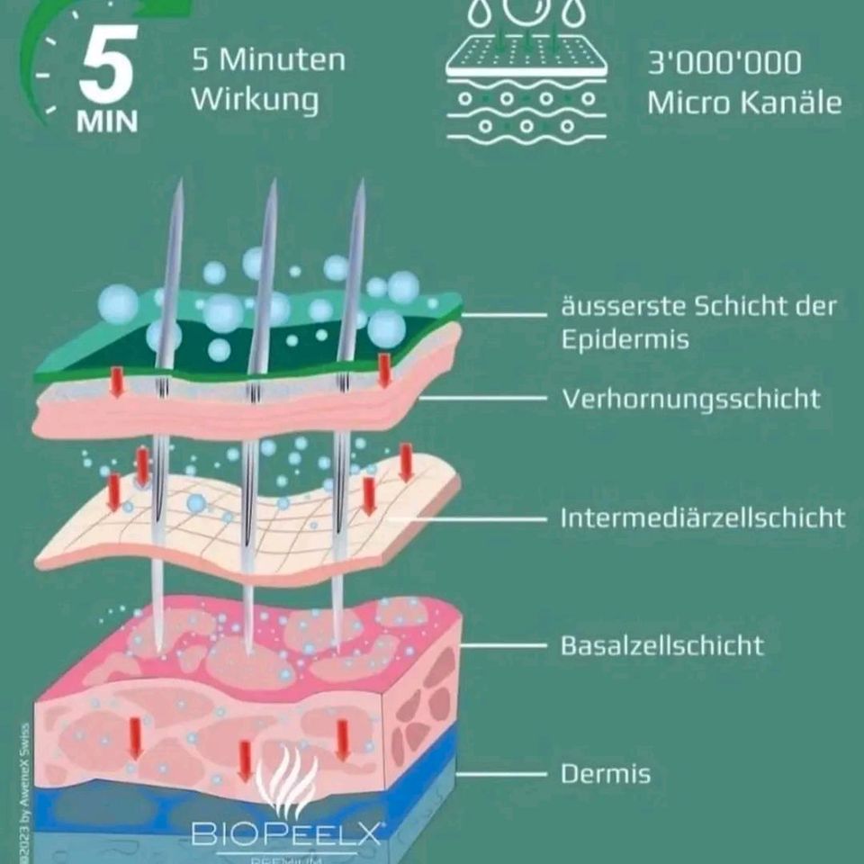 Bio Peeling  Microneedling mit Algen Maske in Mörfelden-Walldorf