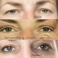 Microneedling & Plasma PEN Behandlungen ab 114 € Rheinland-Pfalz - Speyer Vorschau