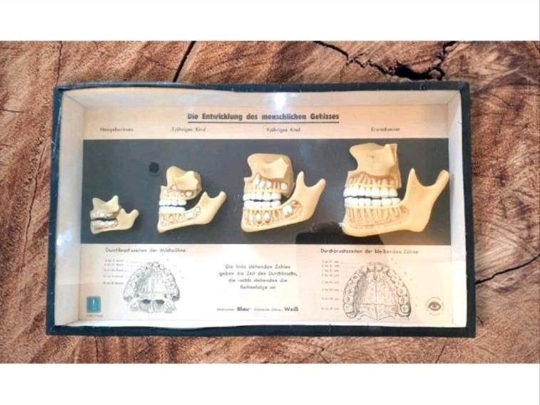 Rarität Schaukasten Modell menschliches Gebiss Vitrinen Zahnarzt in Pössneck