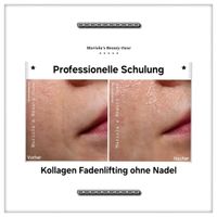 Schulung Fadenlifting Gesichtsbehandlung Kollagen ohne Nadel Saarland - Homburg Vorschau