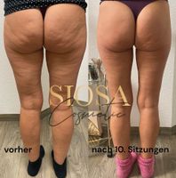 SIOSA Kosmetikstudio | Bodyformer G5 Massage Nordrhein-Westfalen - Moers Vorschau