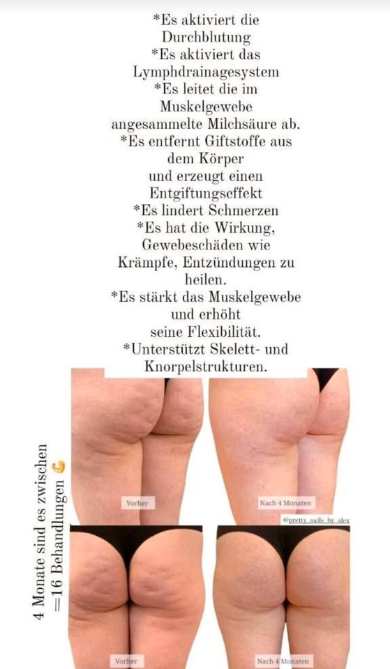 G5 Massage Bodyformer Abnehmen Fettreduktion Cellulite Behandlung in Witten