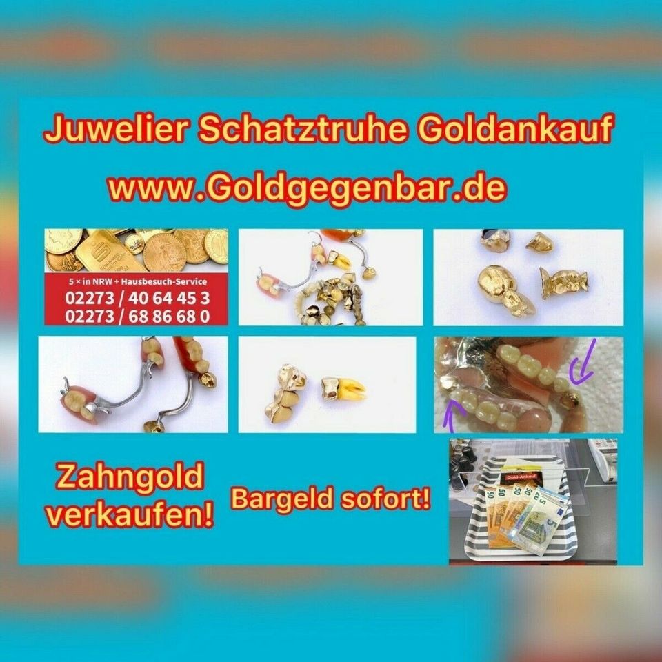 Bergheim Goldankauf Zahngold bis 45€/ Gramm in Rommerskirchen