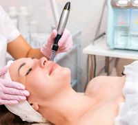 ⚜️ MICRONEEDLING INKL. WIRKSTOFFKOSMETIK ⚜️ Schleswig-Holstein - Norderstedt Vorschau