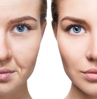 Microneedling + BB Glow Gesichtsbehandlung München - Trudering-Riem Vorschau