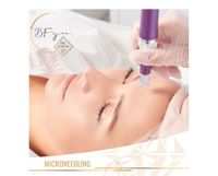 MICRONEEDLING Schleswig-Holstein - Lübeck Vorschau