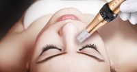 ✨ Wimpernverlängerung Microneedling Zahnbleaching Wimpern BB Glow Nordrhein-Westfalen - Velbert Vorschau