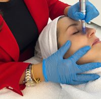 MICRONEEDLING/BB-GLOW/WIMPERNVERLÄNGERUNG/MICROBLADING/LIFTING Nordrhein-Westfalen - Troisdorf Vorschau