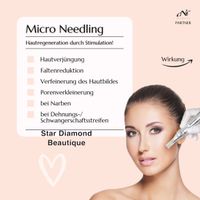 Microneedling Gesichtsbehandlung Gesichtsreinigung Hyaluron Nordrhein-Westfalen - Bottrop Vorschau