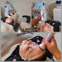 BB-GLOW, Microneedling, Aqua Facial, Gesichtsbehandlung Hessen - Weilburg Vorschau