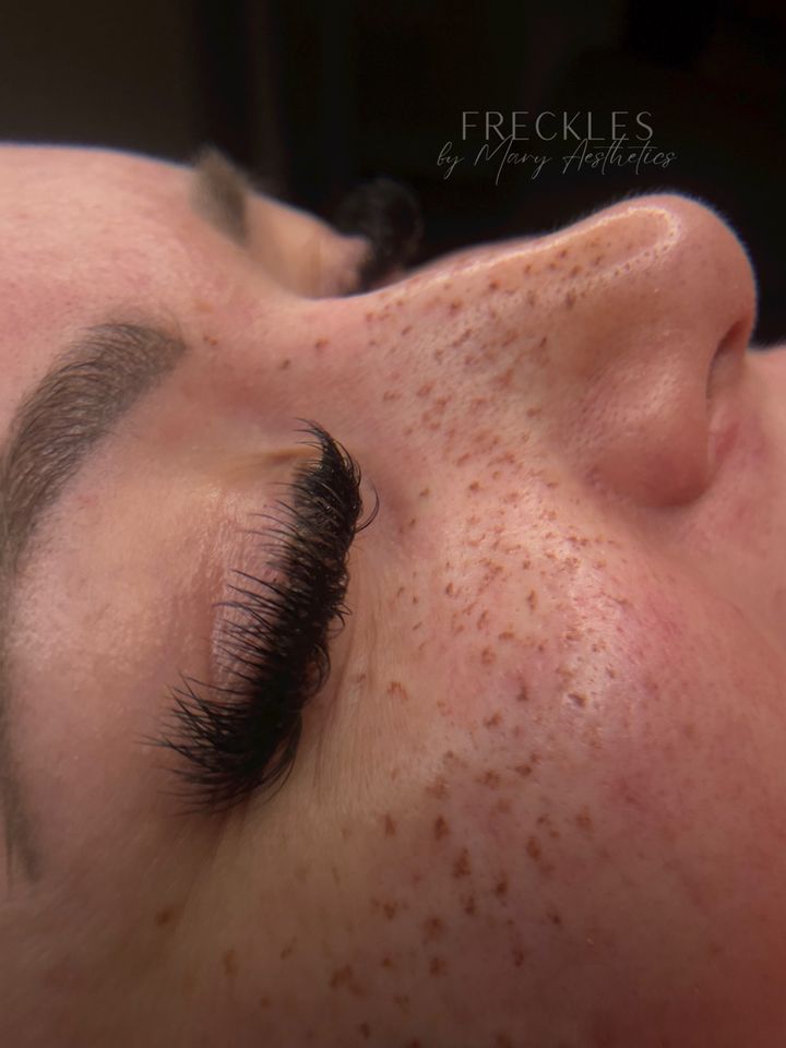 Fake Freckles Sommersprossen Pigmentierung Permanent Make up pmu in Herne