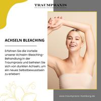 Achseln Bleaching 349€ Facarztpraxis Jungfernstieg Hamburg Hamburg-Mitte - Hamburg Altstadt Vorschau