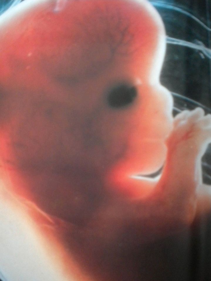 Embryonalentwicklung 1.Tag bis 9.Monat Baby in Frankfurt am Main