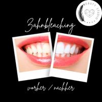Zahnbleaching weiße Zähne Bleaching Niedersachsen - Burgwedel Vorschau