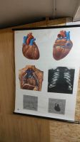 Anatomie Poster Dekoration Medizin Thüringen - Hildburghausen Vorschau