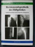 Revisionsendoprothetik des Hüftgelenks Schaftrekonstruktion Niedersachsen - Göttingen Vorschau