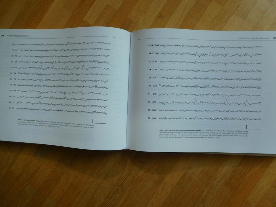 EEG Atlas Elektroenzephalografie bei Kindern und Erwachsenen in München