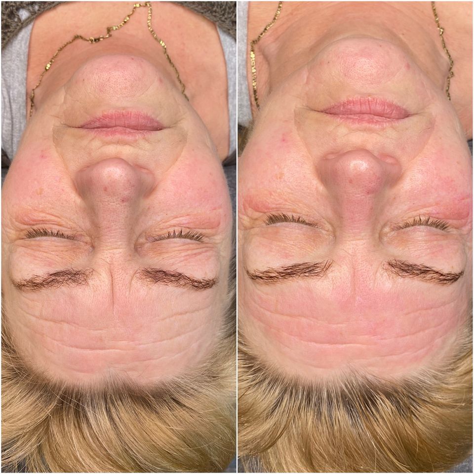 Vitamin Brows Microneedling BB Glow Schulung auch mobil möglich in Bremen