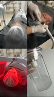 Hydrafacial - Tiefenreinigung Nordrhein-Westfalen - Langenfeld Vorschau