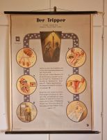 Historisch - medizinische Lehrtafel, Roll Plakat,  "Tripper" 1951 Baden-Württemberg - Pforzheim Vorschau