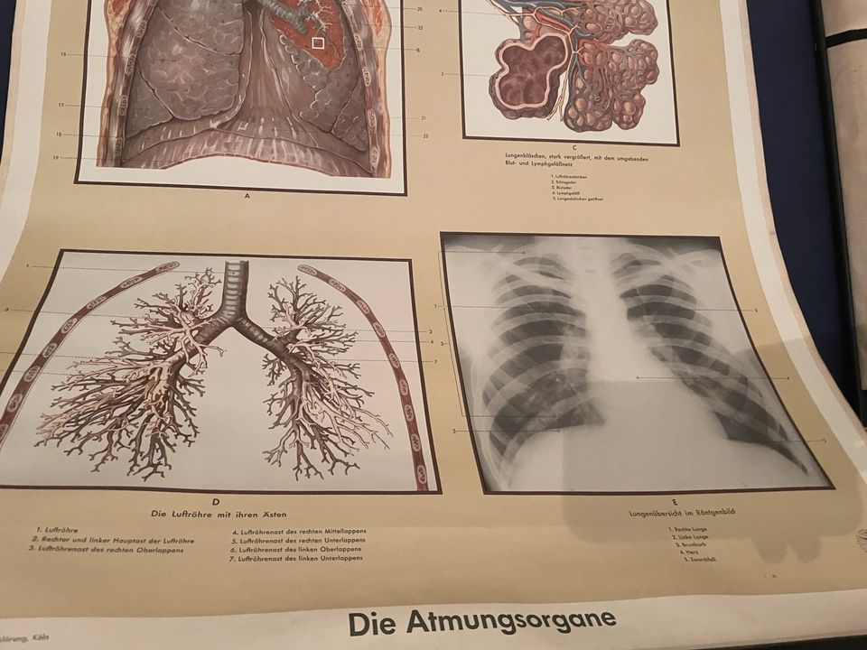 Alte Rollkarte 2 Wandkarten Schulkarten Lehrtafel Anatomie Organe in Reichenbach (Vogtland)