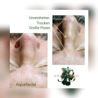 Hydrapeel Aquapeel Aquafacial Hydrofacial Peeling Nordrhein-Westfalen - Alfter Vorschau